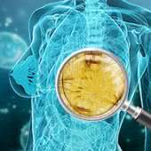 脂肪注入豊胸の定着に関するQ&A