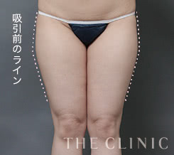 施術前