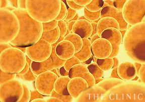 脂肪専門クリニックだからこそできる、人工物を使わない施術をご提案いたします。