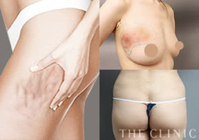 失敗の修正治療も積極的に受け付けています。