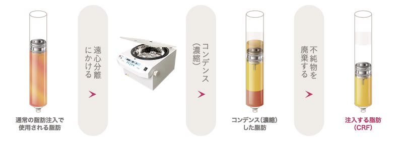 ①不純物を除去するコンデンス(濃縮)技術を採用