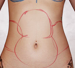 一般的なマーキング