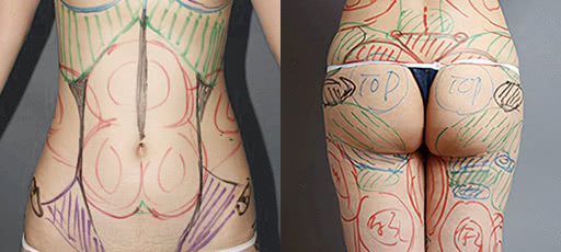 THE CLINIC のマーキング