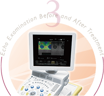 術前後のエコー検査