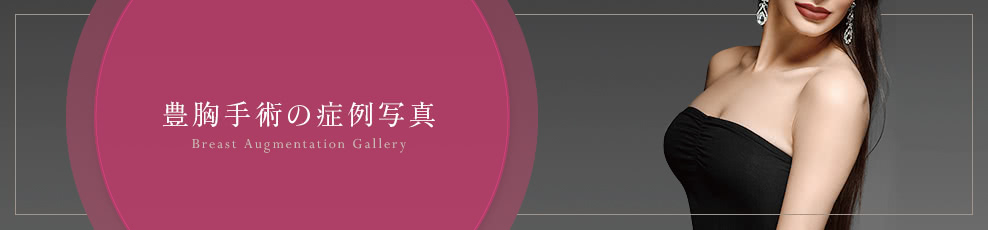豊胸・胸の整形の症例写真