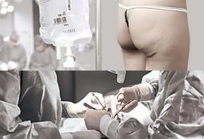 リスクや副作用についても詳しくお話します