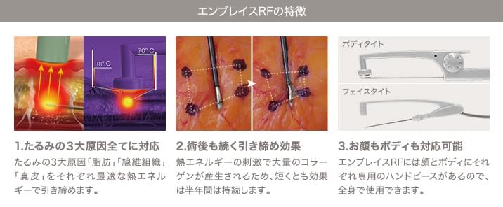 エンブレイスRFの特徴