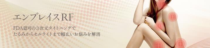 エンブレイス